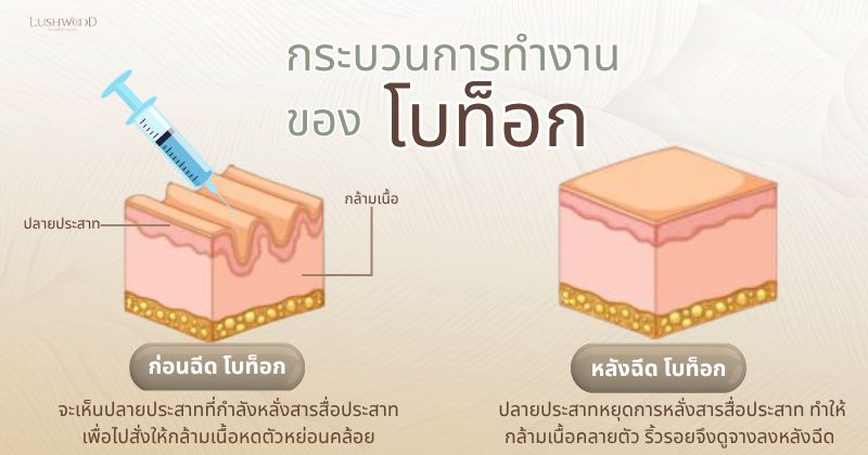 โบท็อกซ์ ดีไซน์ ออริจินัล