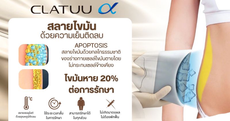 สลายไขมันด้วยความเย็น (Clatuu)