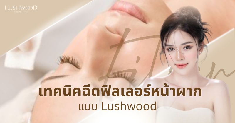 Forehead Filler