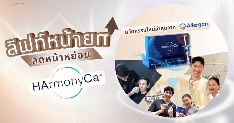 ฮาร์โมนีซีเอ