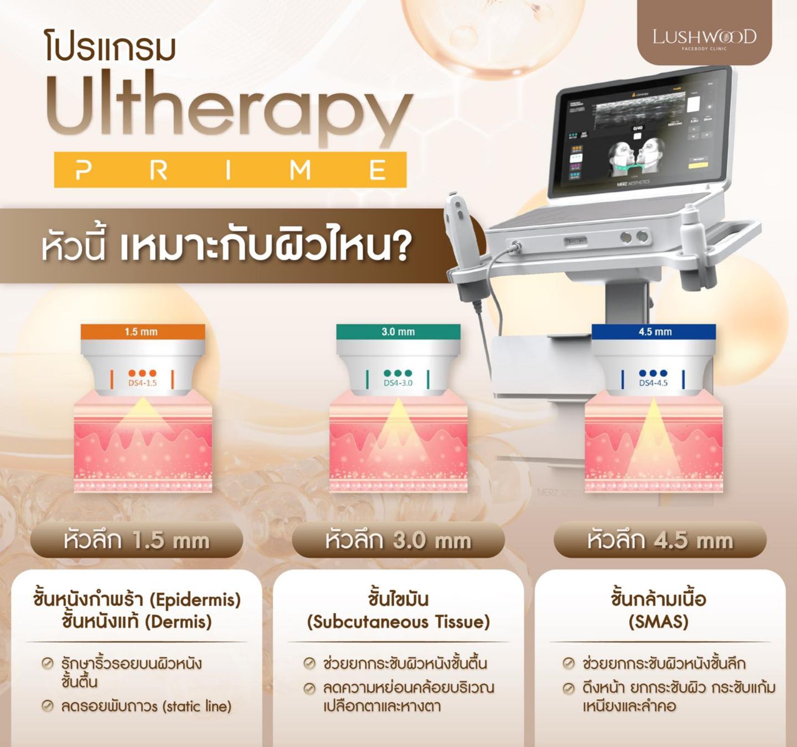 อัลเทอร่าไพร์ม