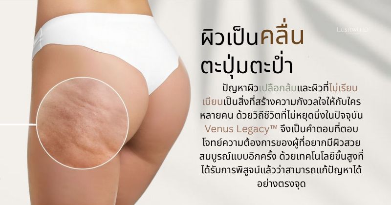 วีนัส เลกาซี่